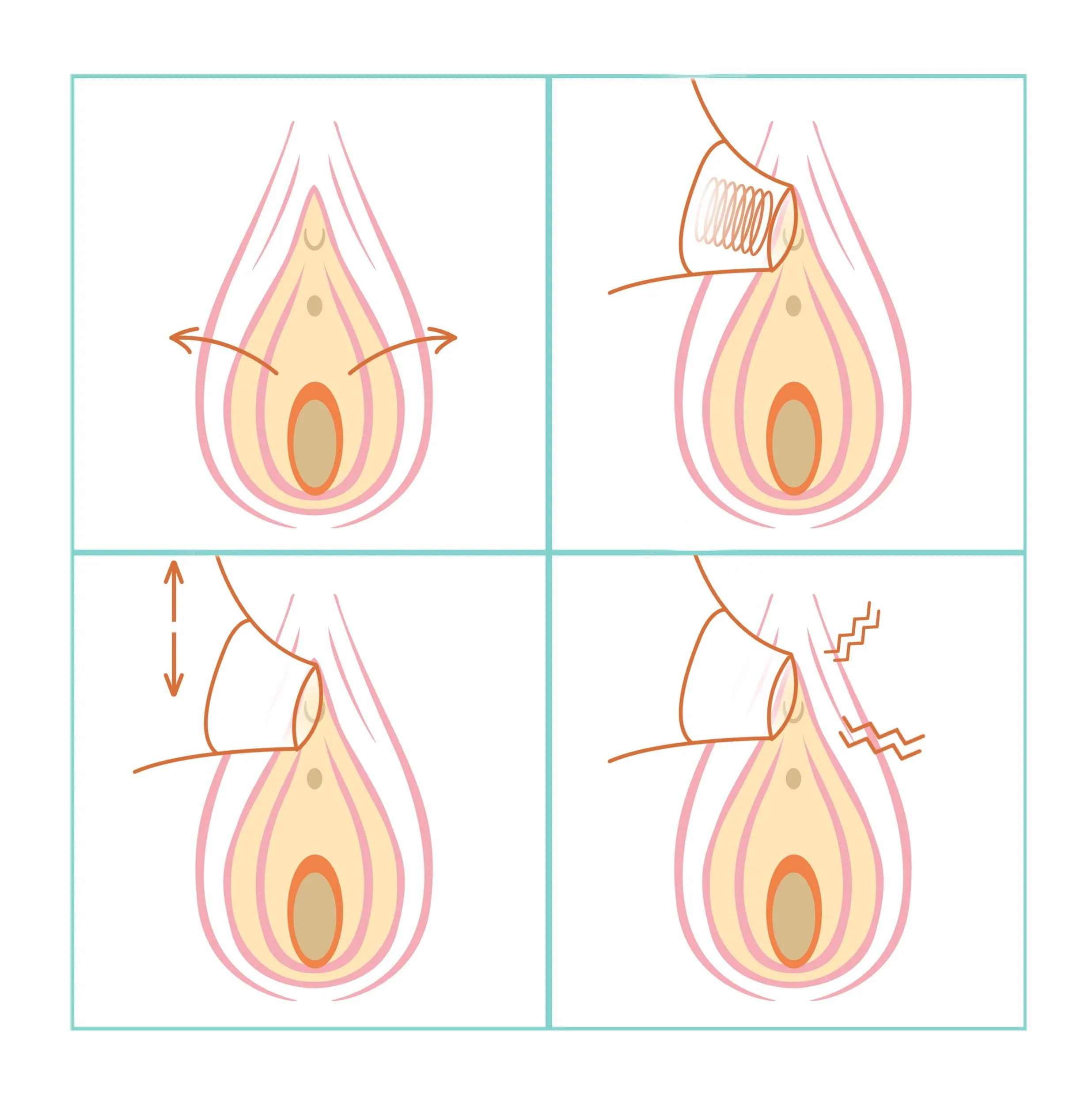 We-Vibe Melt